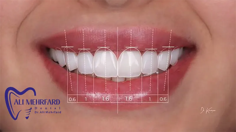 کامپوزیت دیجیتال 5 Digital composite