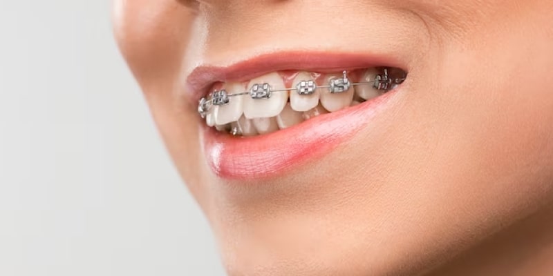 Orthodontics service min