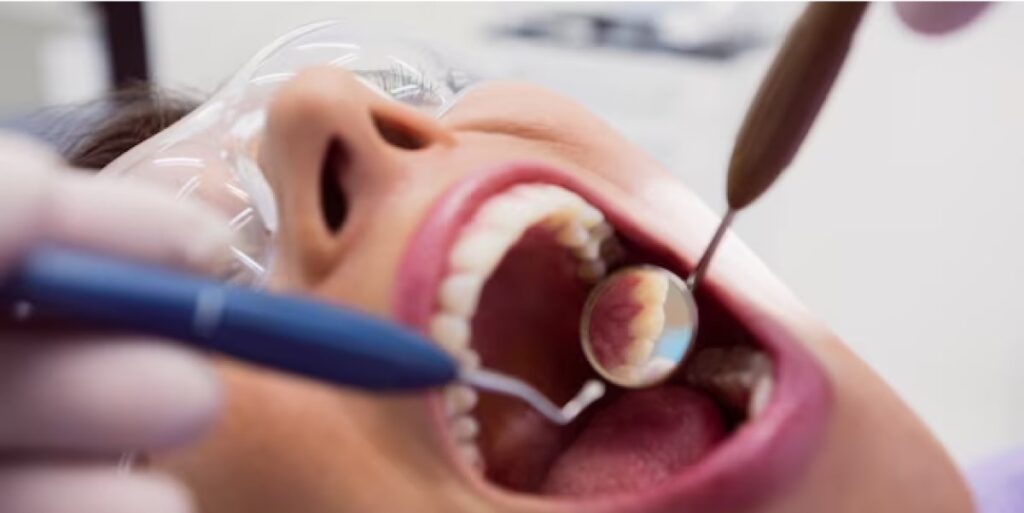 rootcanal service min