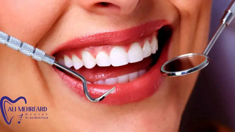 مراقبت های بعد از لمینت دیجیتال ماندگاری و مراقبت های بعد از لمینت دیجیتال