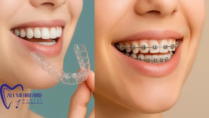 مراحل ارتودنسی دیجیتال از اسکن سه بعدی تا درمان نهایی