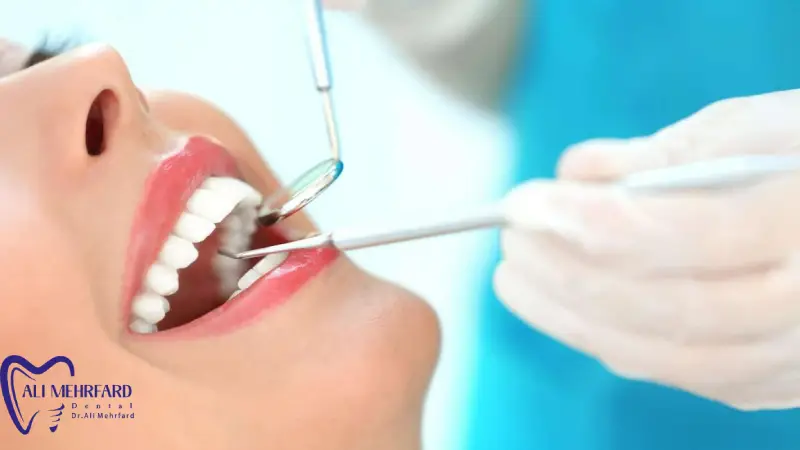 تایید طرح لبخند دیجیتال شبیه سازی و تایید نهایی طرح لبخند در لمینت دیجیتال