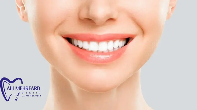 مزایای لمینت دیجیتال مزایای لمینت دیجیتال نسبت به لمینت سنتی