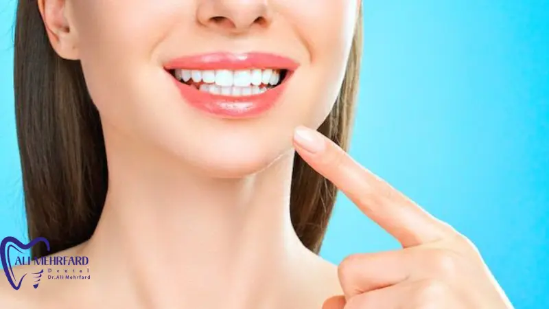 هماهنگی لمینت دیجیتال با لبخند هماهنگی لمینت دیجیتال با صورت و خط لبخند
