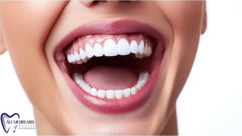 نقش طراحی لبخند دیجیتال در افزایش رضایت بیمار