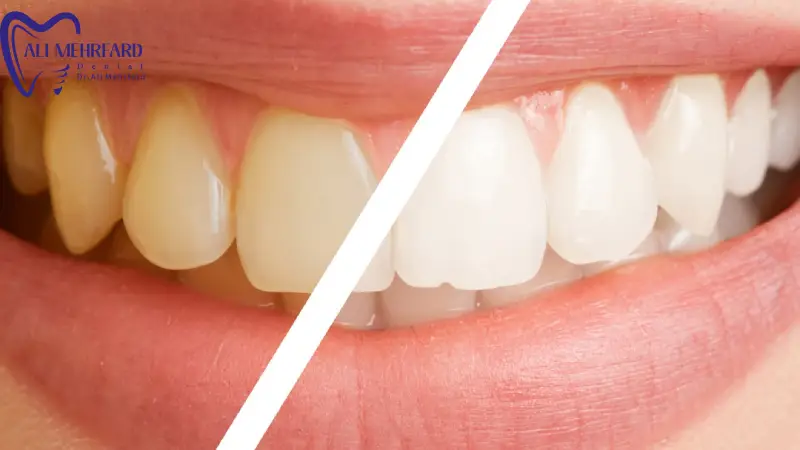 هر چند وقت یک بار باید جرم گیری انجام شود؟