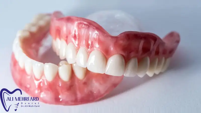 تفاوت پروتز دیجیتال و سنتی مقایسه کامل دقت، زمان، هزینه و کیفیت در سال 2025
