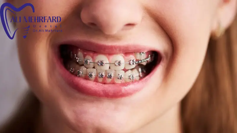مثال های واقعی برای درک بهتر انتخاب روش