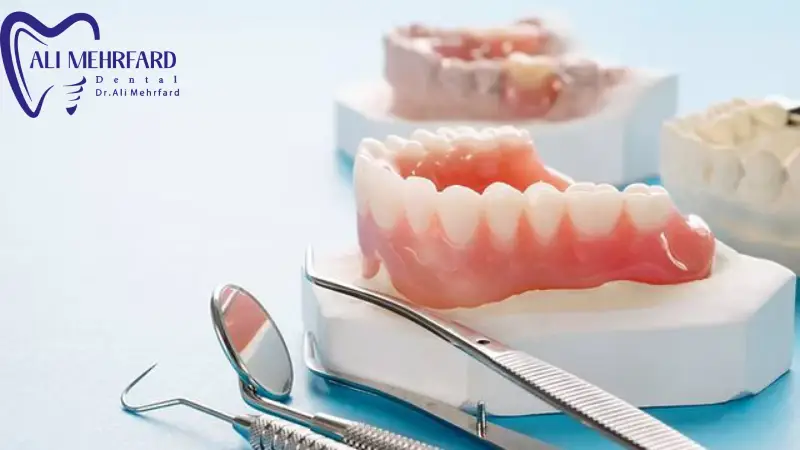 پروتز دیجیتال چیست؟