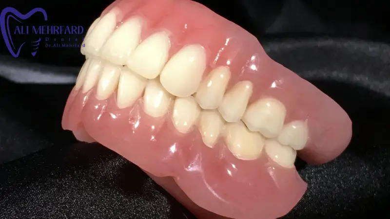 کدام روش پروتز برای چه بیمارانی مناسب تر است؟