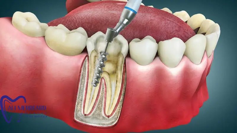 کلینیک تخصصی دندان پزشکی دیجیتال دکتر علی مهرفرد