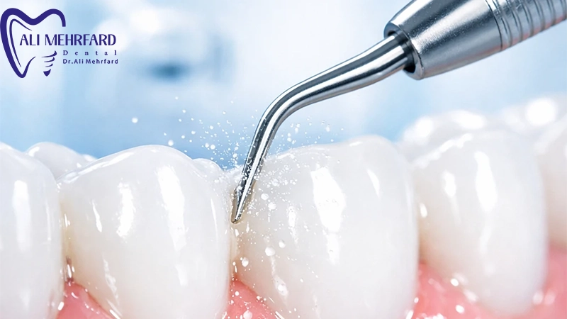 سوالات متداول درباره اینکه هر چند وقت یکبار جرم گیری لازم است؟