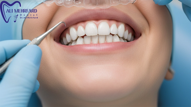طراحی لبخند دیجیتال در کلینیک دکتر علی مهرفرد