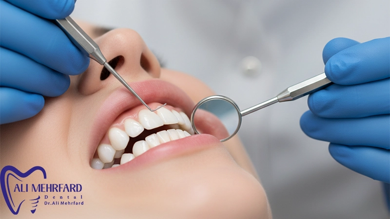 نقش سلامت لثه در نتیجه طراحی لبخند