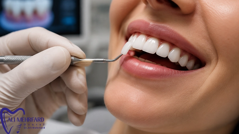 لمینت دیجیتال دندان برای چه افرادی مناسب است؟ بررسی کامل مزایا، شرایط و کاندیدای ایده آل