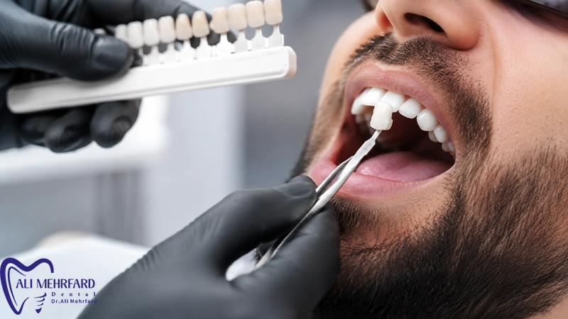 چه افرادی گزینه مناسبی برای لمینت دیجیتال نیستند؟