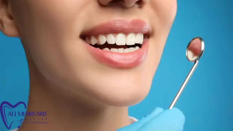 بلیچینگ برای چه افرادی مناسب نیست؟ راهنمای کامل قبل از سفید کردن دندان ها