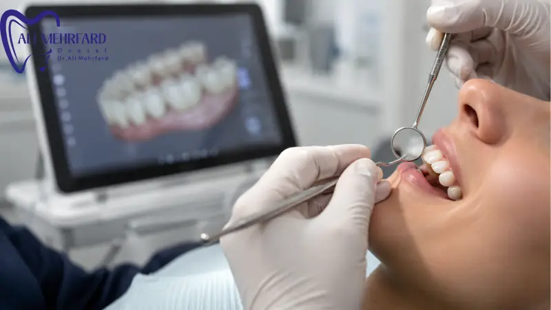 لمینت دیجیتال چیست و چرا روی دوام تاثیر دارد؟
