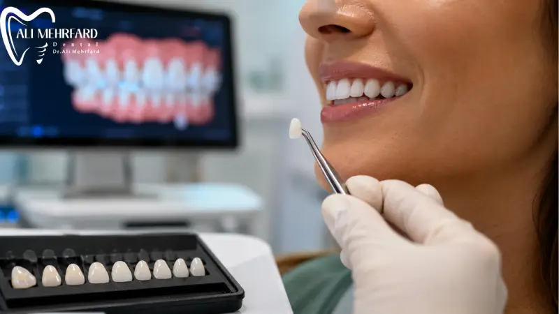 چگونه ماندگاری لمینت دیجیتال را بیشتر کنیم؟