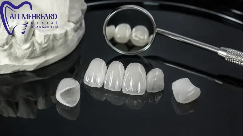 آیا لمینت دیجیتال از لمینت معمولی گران تر است؟