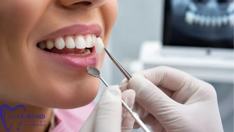 کامپوزیت دیجیتال یا لمینت؟ | مقایسه مزایا و ماندگاری 3 محدودیت ها و عوارض احتمالی لمینت