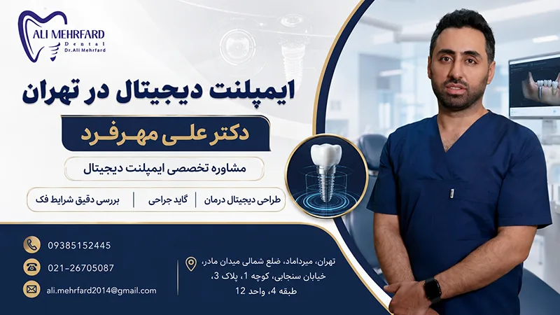 ایمپلنت دیجیتال در تهران توسط دکتر علی مهرفرد